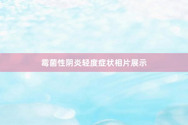 霉菌性阴炎轻度症状相片展示